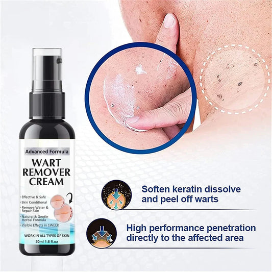 wart remover cream  PACK OF 2