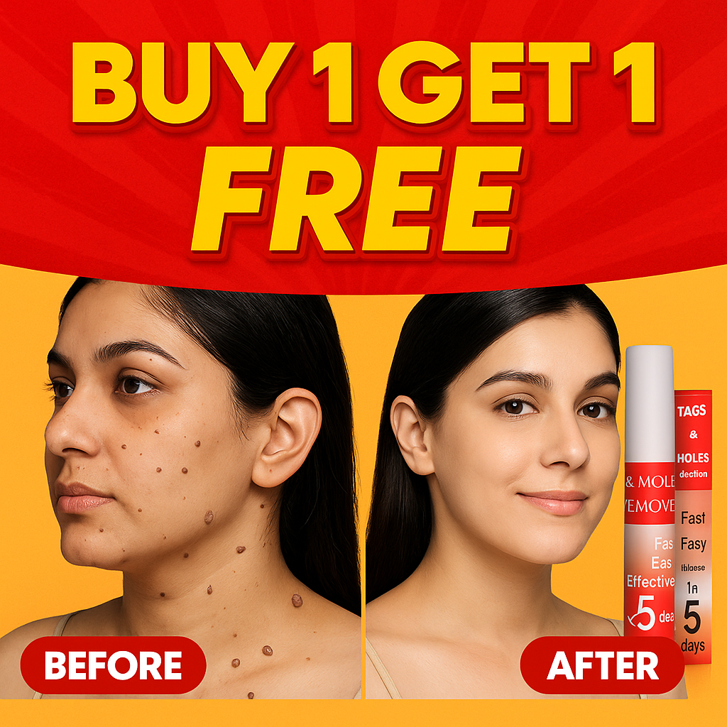 Warts & Tags Remover Pen - (Buy 1 Get 1 FREE🔥🔥)