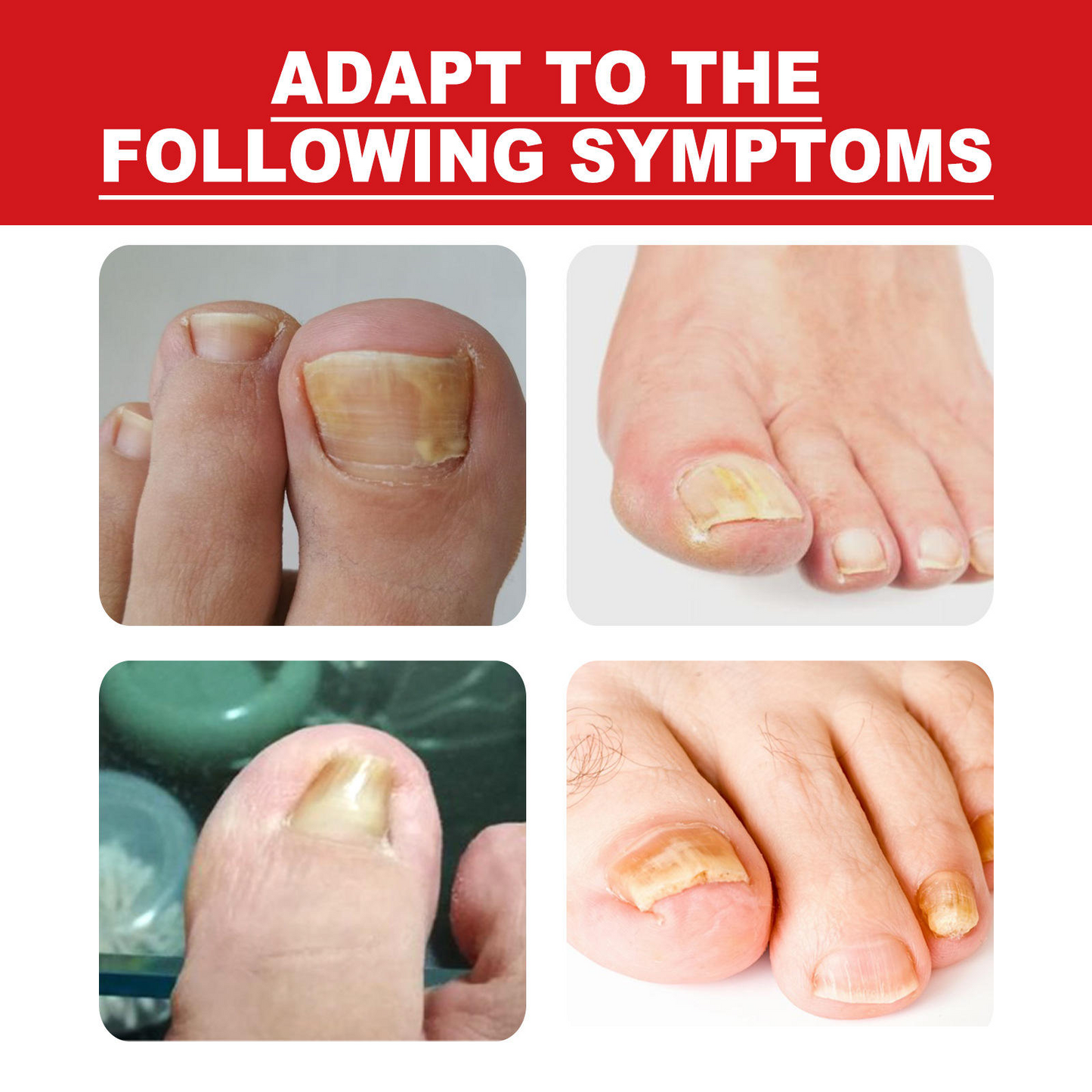 Southmoon Ingrown Toenail Drops Nail Repair Oil (BUY 1 GET 1 FREE🔥🔥)