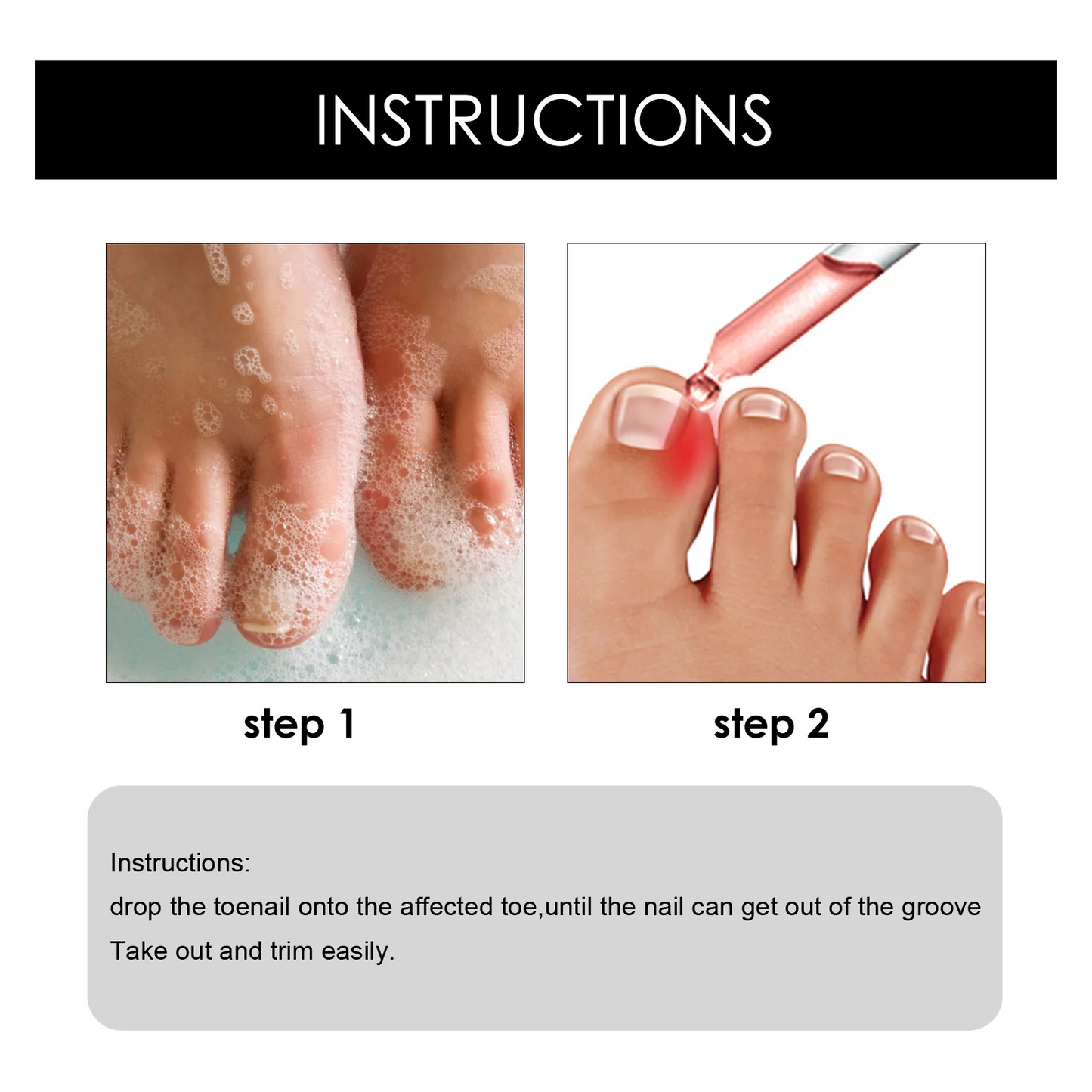 Southmoon Ingrown Toenail Drops Nail Repair Oil (BUY 1 GET 1 FREE🔥🔥)