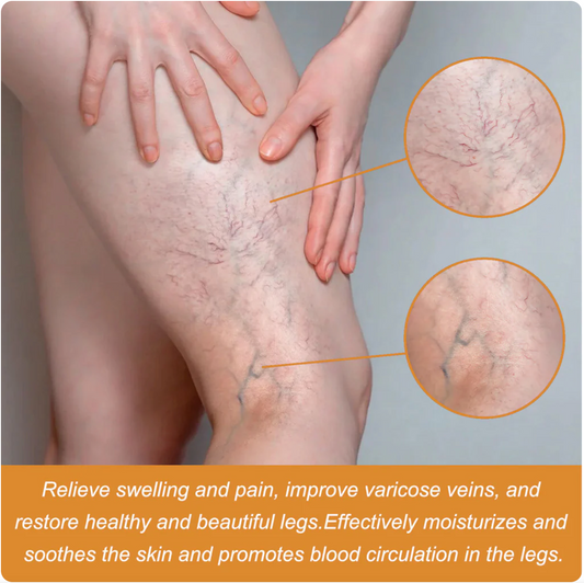 Turmeric Varicose Veins Relief Spray - (Buy 1 Get 1 FREE🔥🔥)